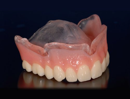 How To Get The Best From Your Dental Lab Wiand Dental Lab