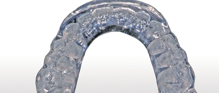 CLEARsplint