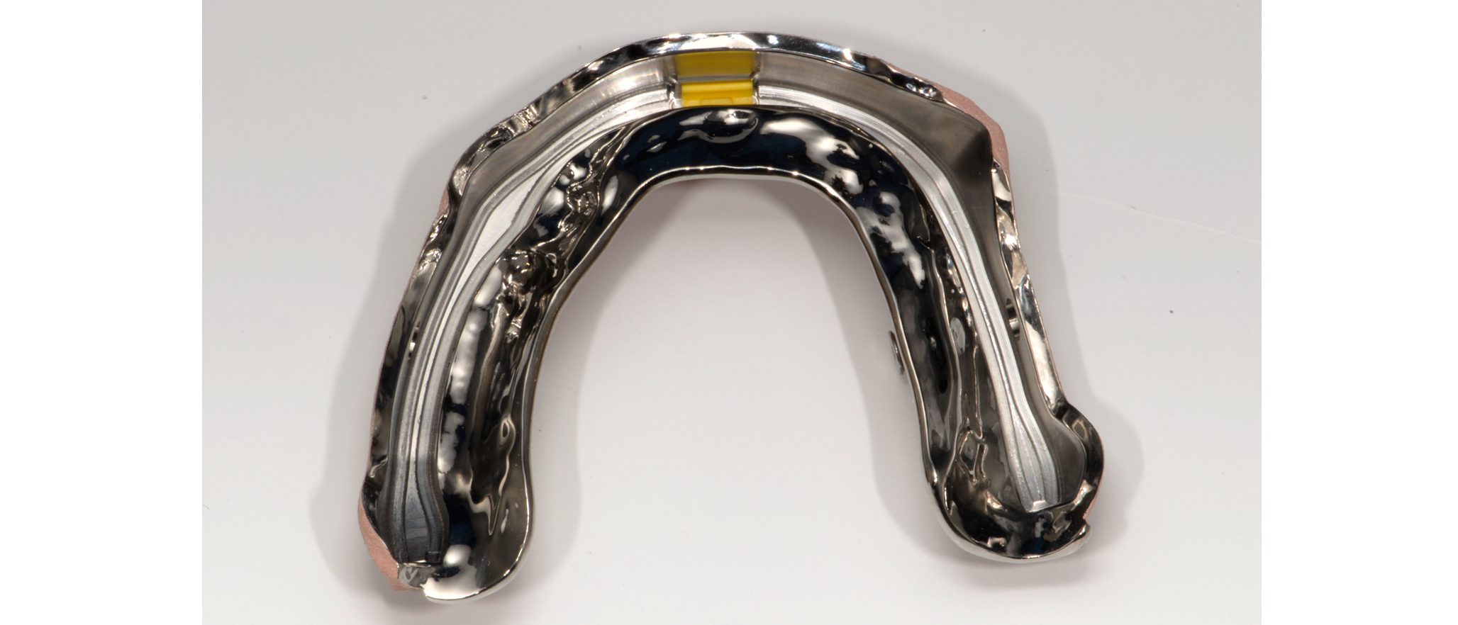 CAD/CAM Implant Bar Design in Arizona - Titanium Dental Implant Bars