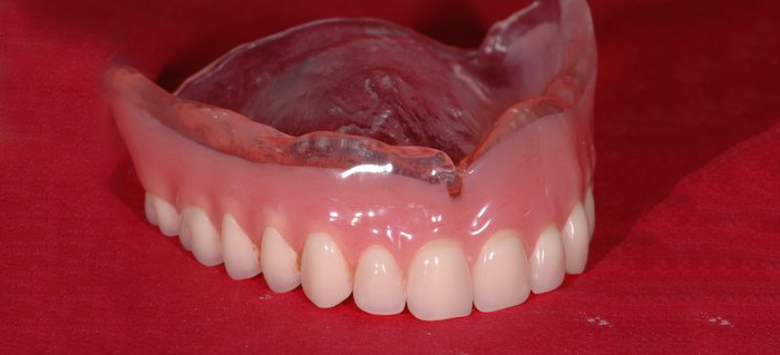 same day denture relines