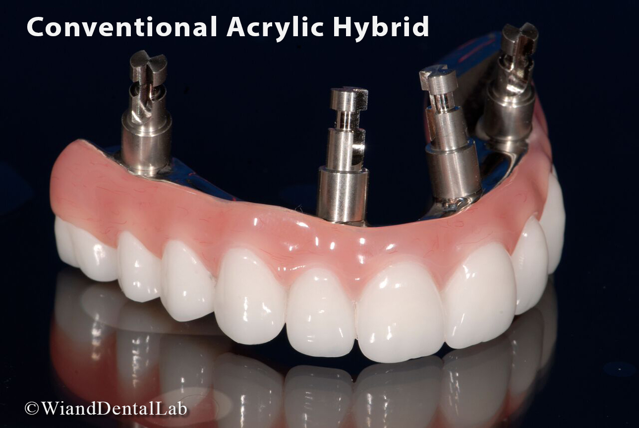 Conventional Acrylic Hybrid