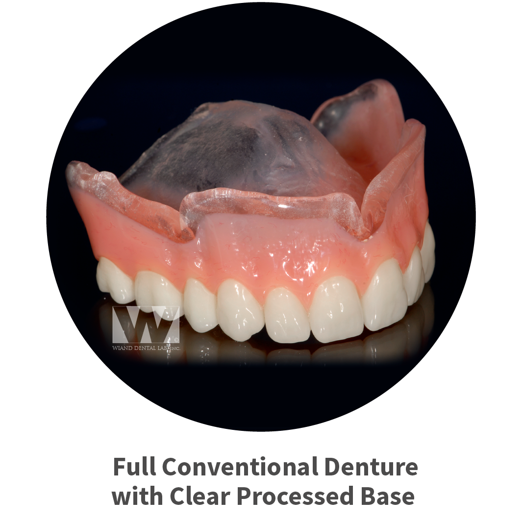Dental Labs in Arizona Removable and Implant Supported Denture