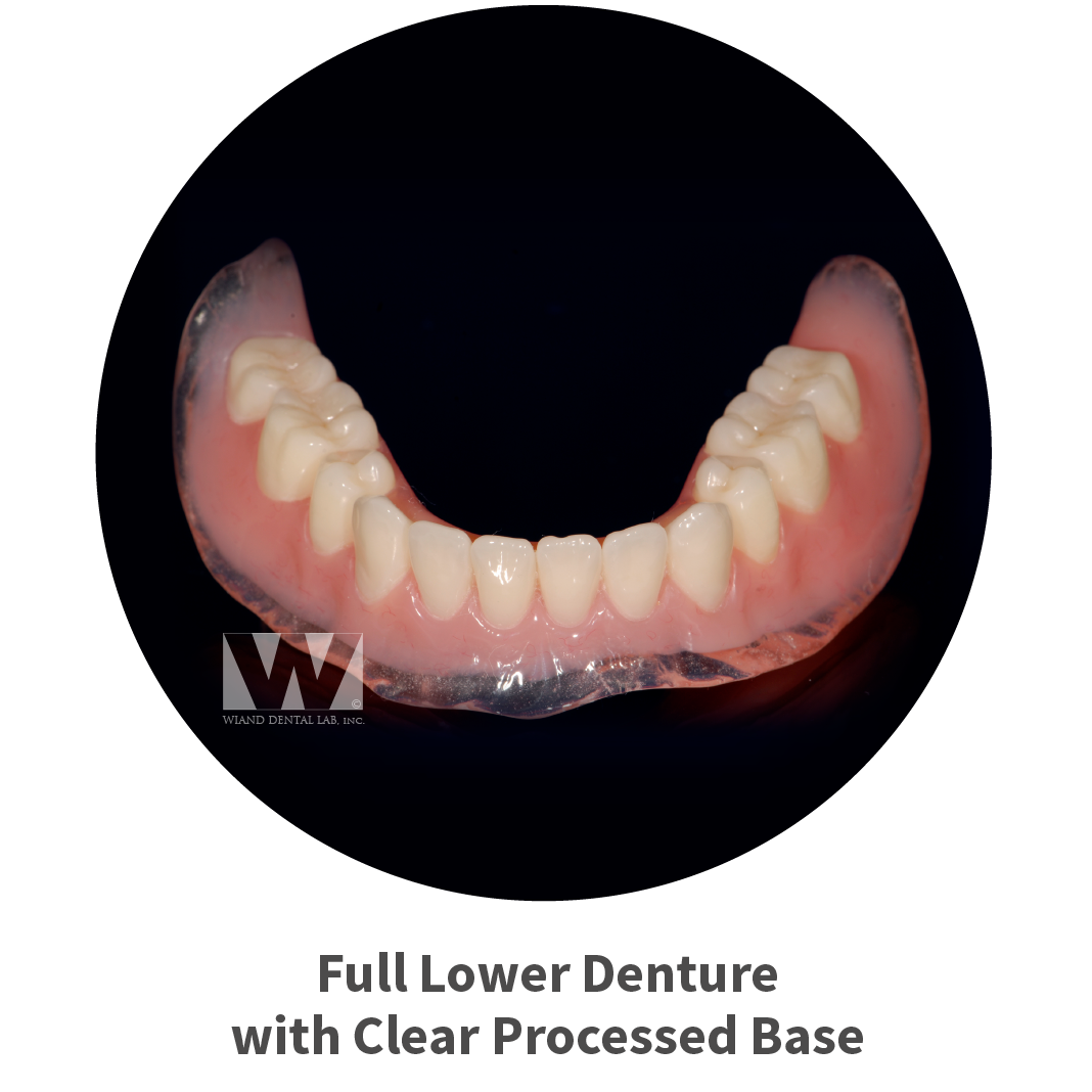 Dental Labs in Arizona Removable and Implant Supported Denture