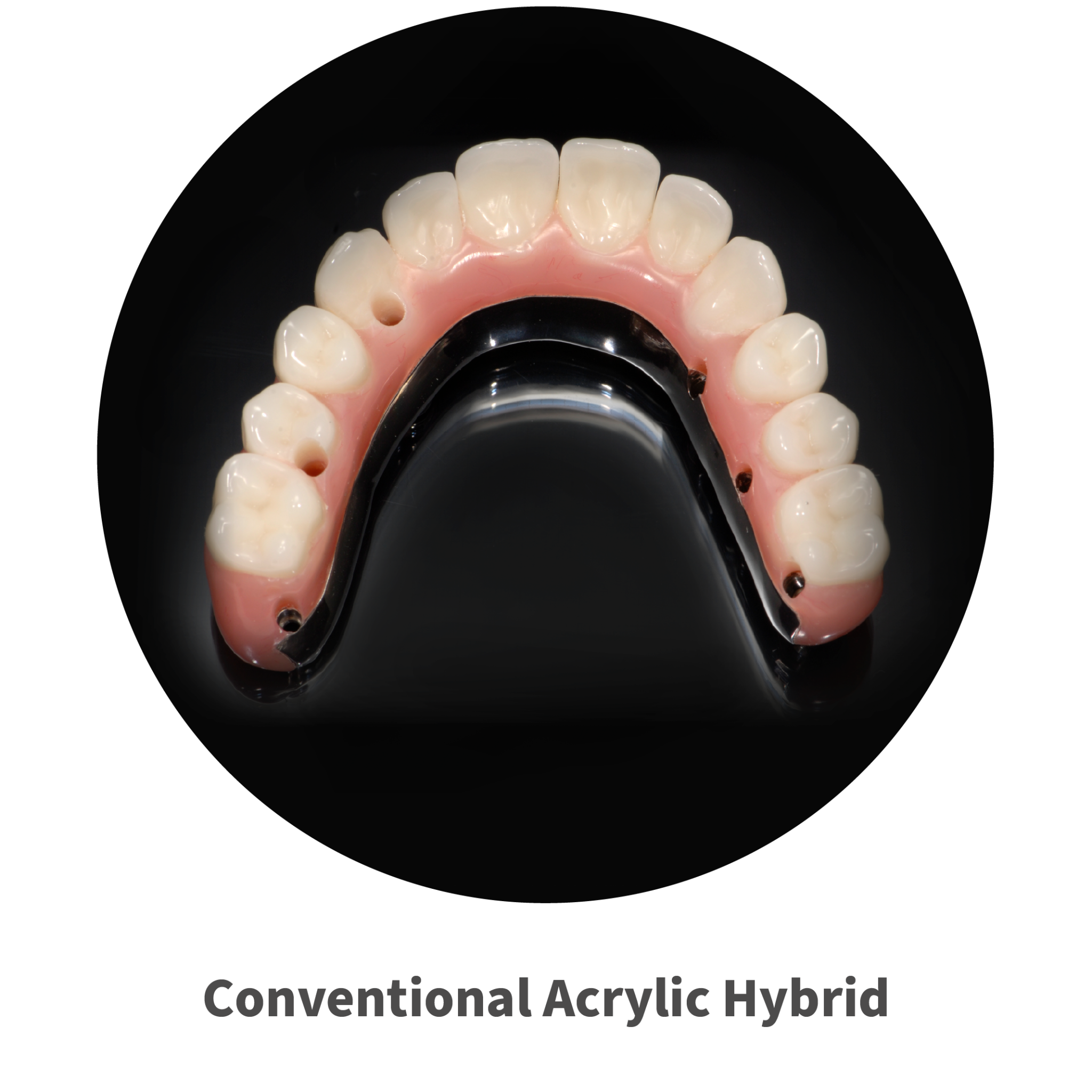 conventional acrylic hybrid