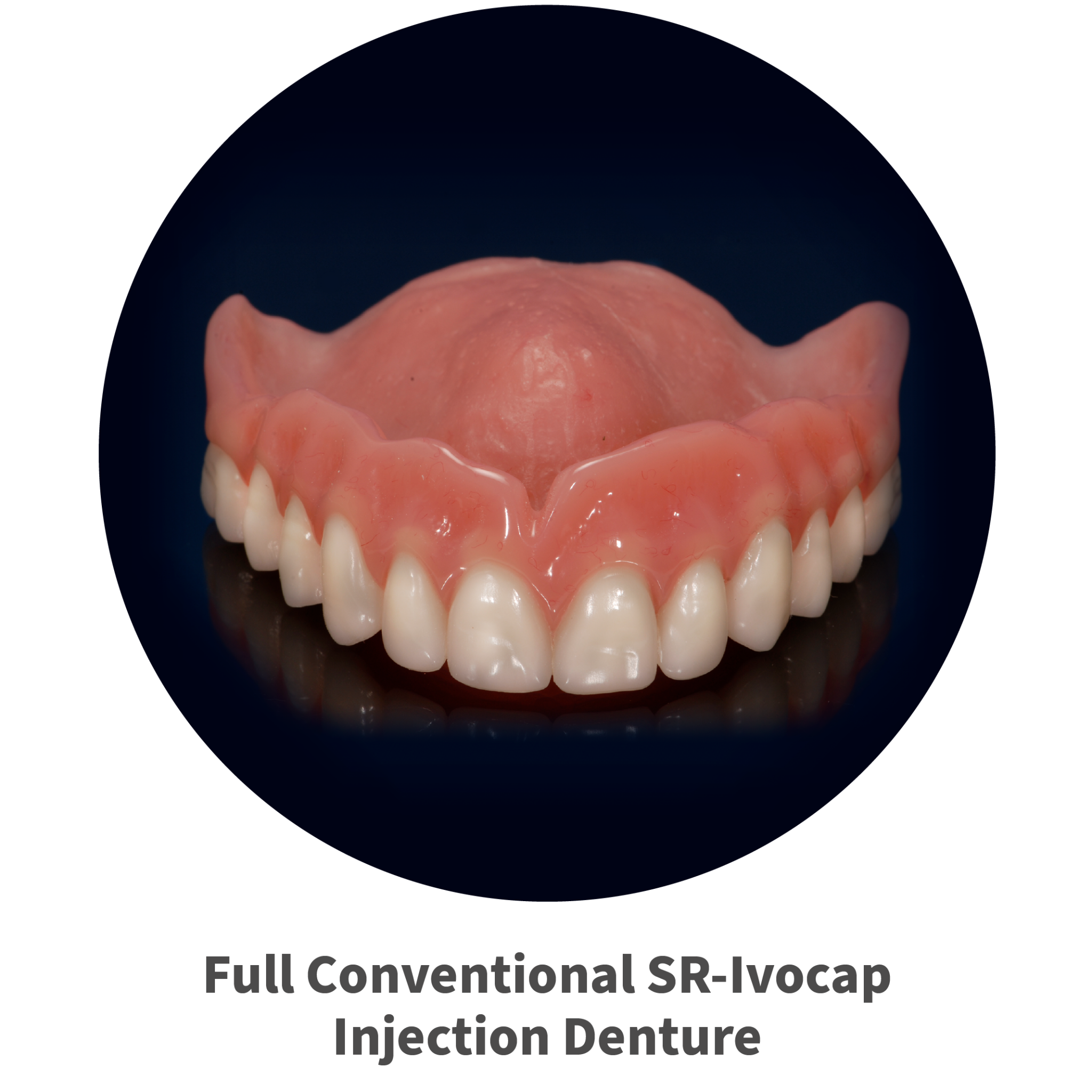 full conventional SR-Ivocap Injection Denture