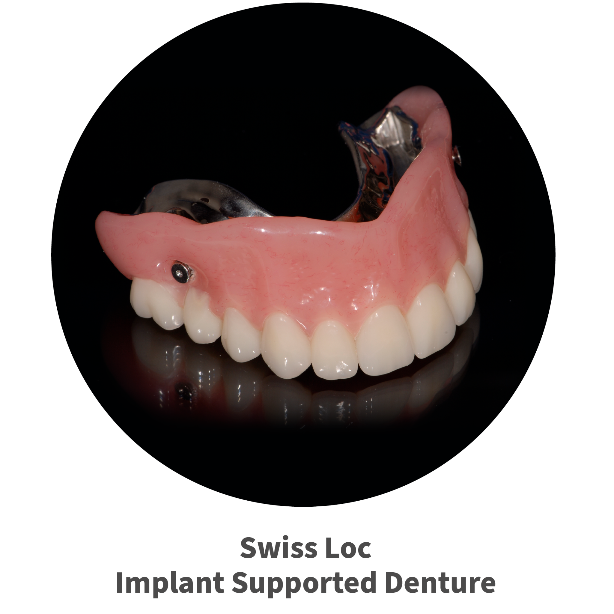 Swiss Loc Implant Supported Denture