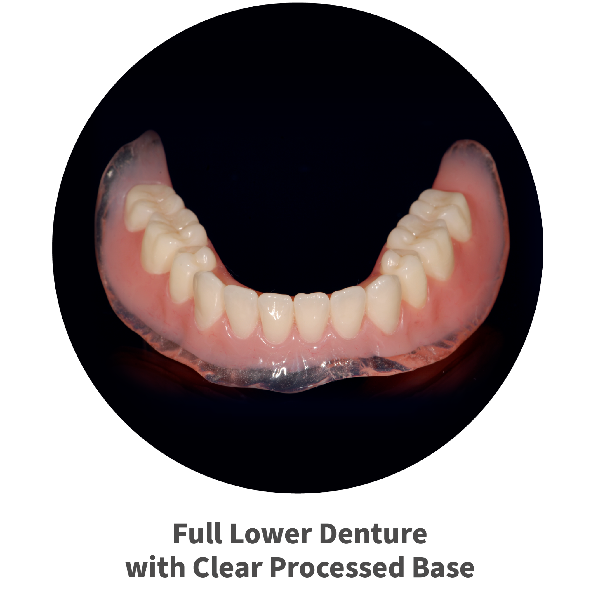 Full Lower Denture with Clear Processed Base