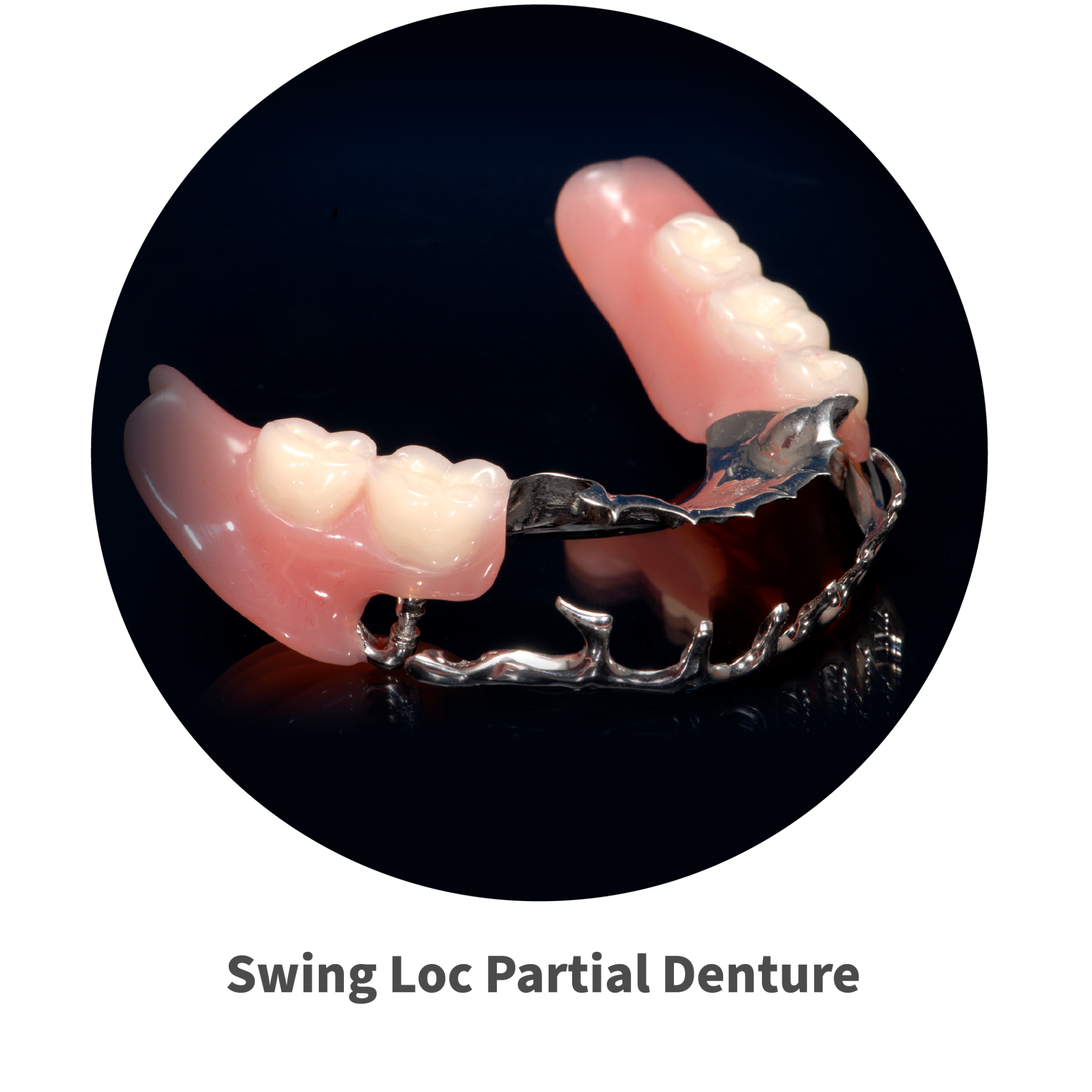 swing loc partial denture