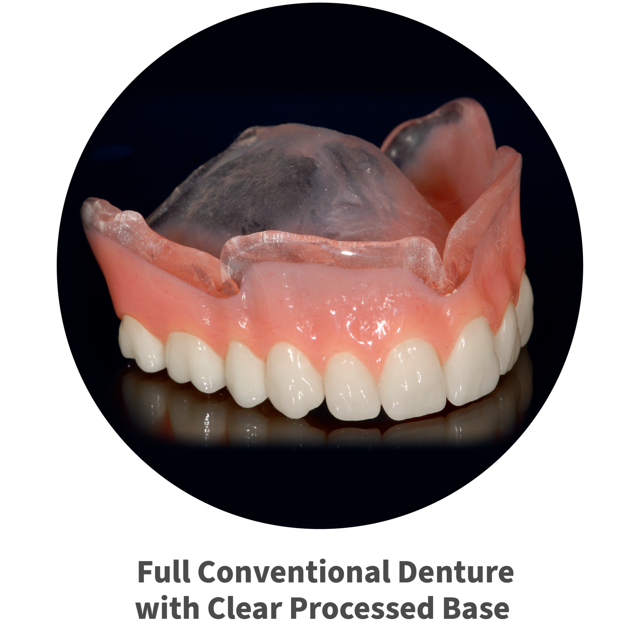 full conventional denture with clear processed base