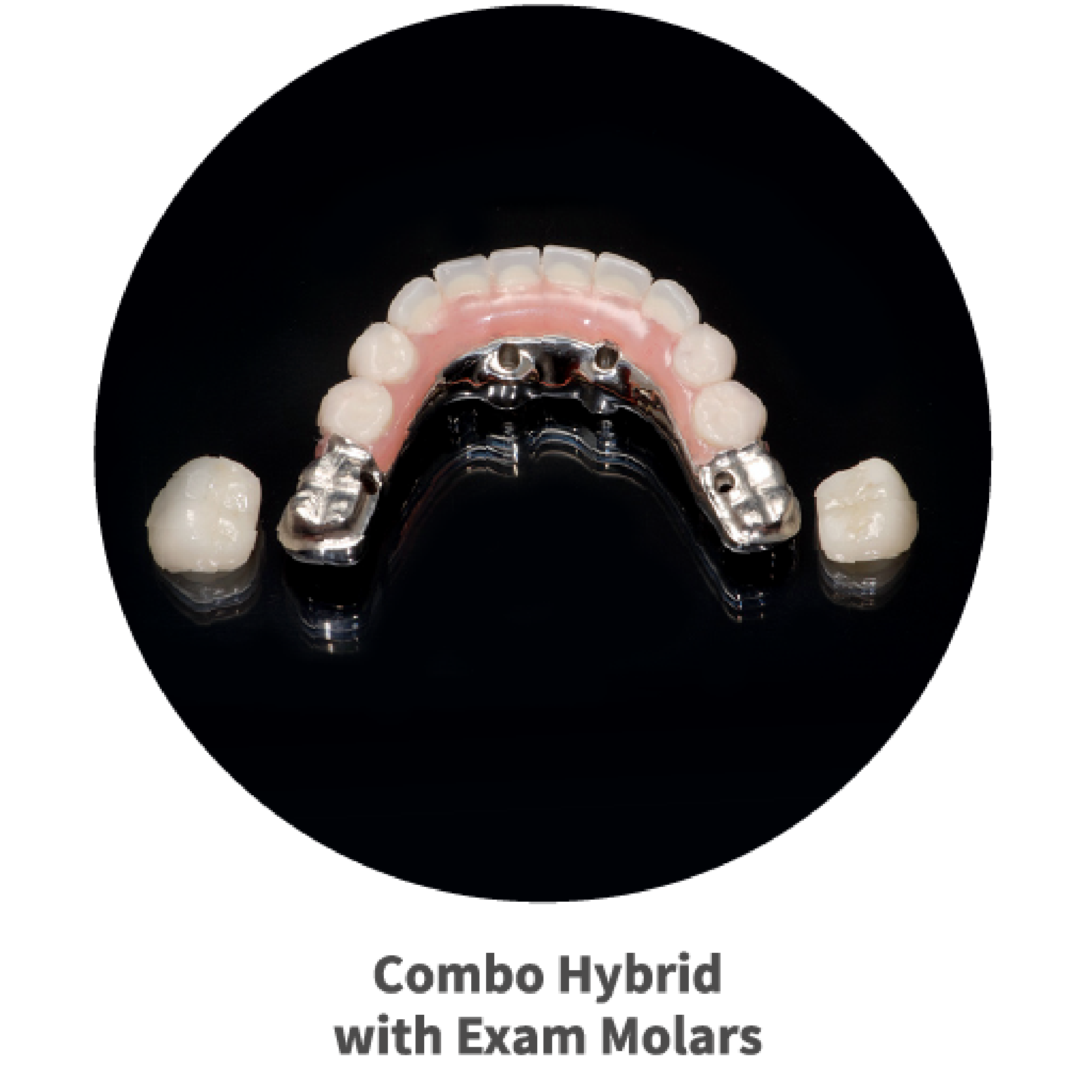combo hybrid with exam molars removable dental prosthetic