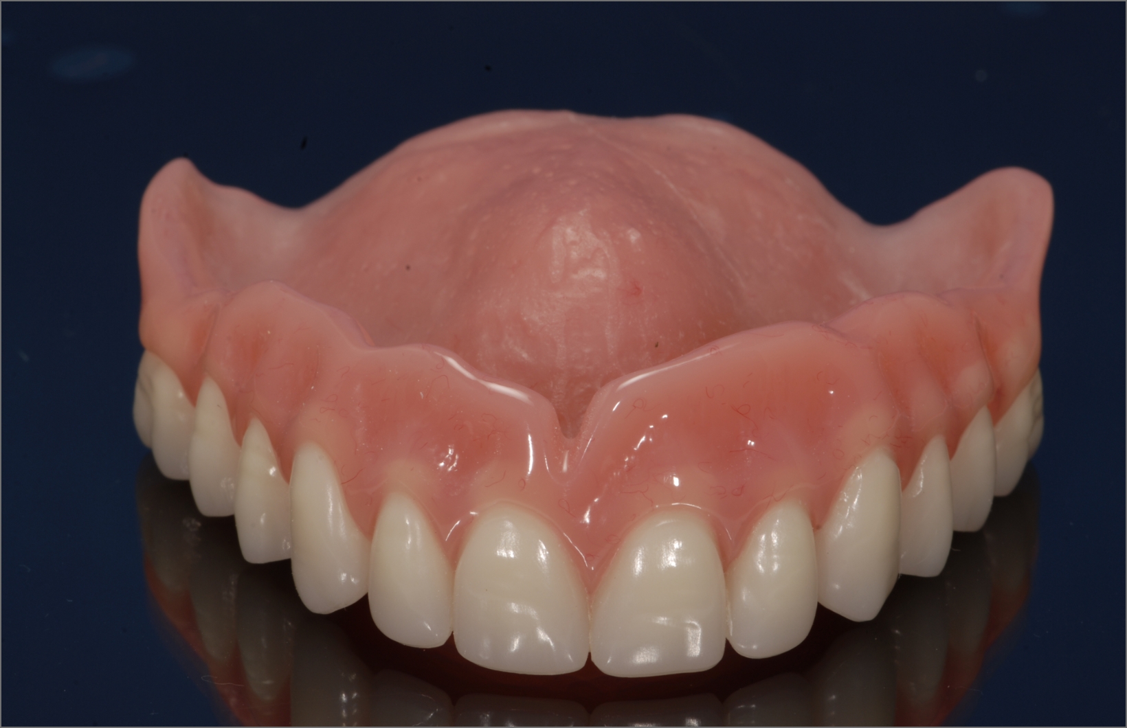 Dental Labs for Dentures in Arizona Conventional Full and Partial