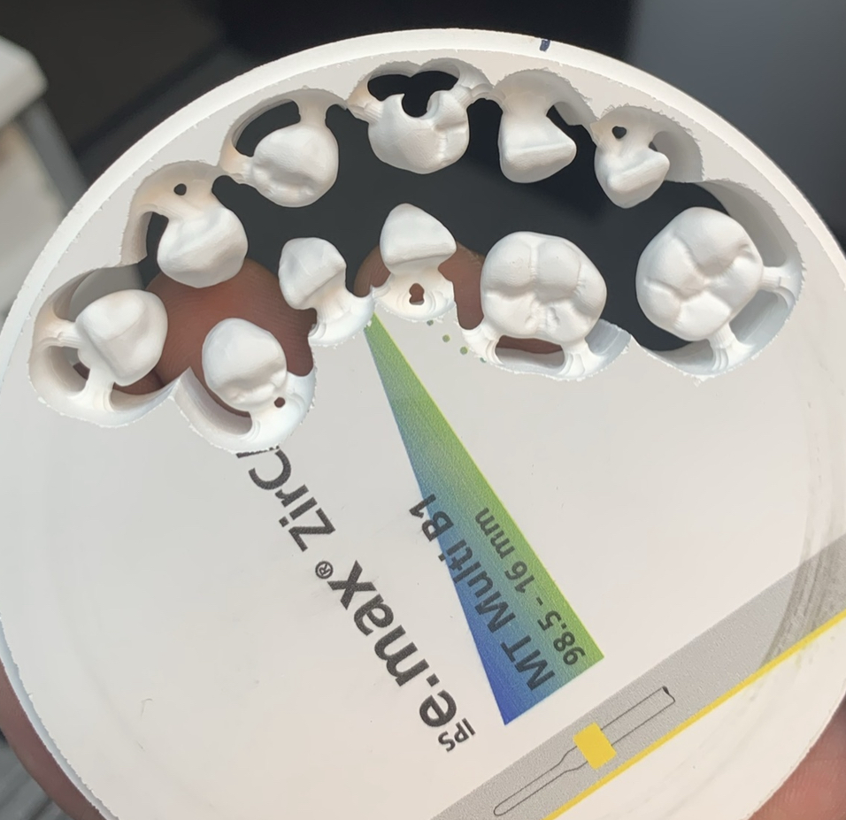 Dental Labs for Dentures in Arizona Conventional Full and Partial