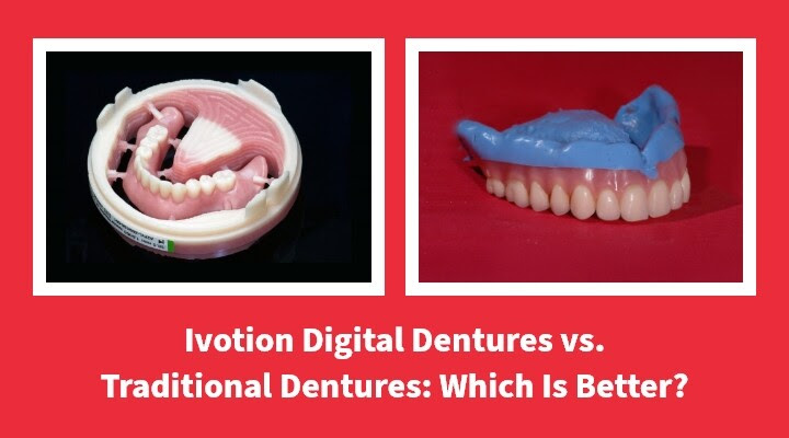 Ivotion Digital Dentures vs. Traditional: Which Is Better?