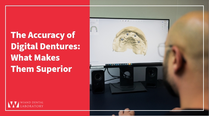 The Accuracy of Digital Dentures: What Makes Them Superior