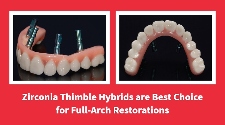 Zirconia Thimble Hybrids Are Best Choice for Full-Arch Restorations