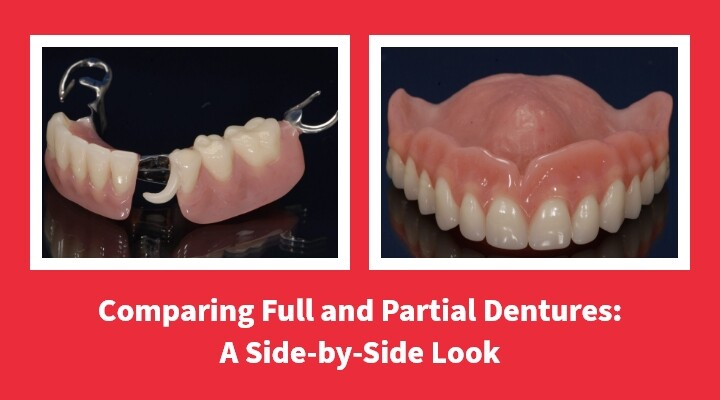Comparing Full and Partial Dentures: A Side-by-Side Look