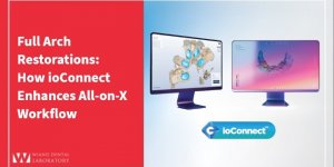 Full Arch Restorations: How ioConnect Enhances All-on-X Workflow