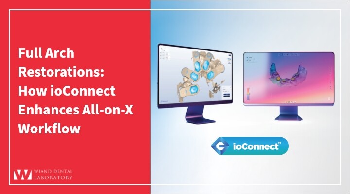 Full Arch Restorations: How ioConnect Enhances All-on-X Workflow
