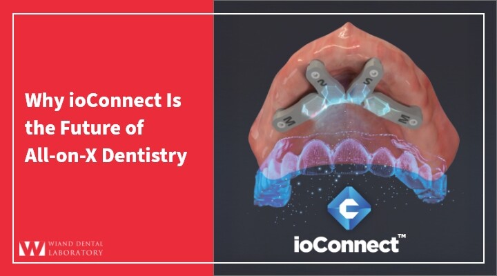 Why ioConnect Is the Future of All-on-X Dentistry