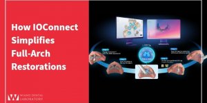How IOConnect Simplifies Full-Arch Restorations