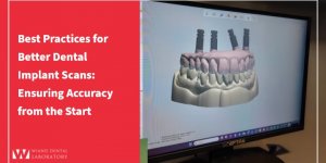 Best Practices for Better Dental Implant Scans: Ensuring Accuracy from the Start