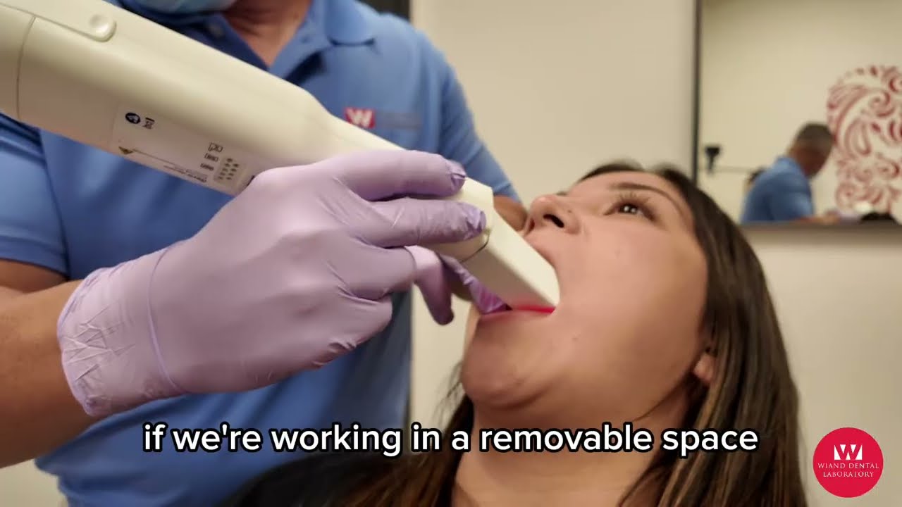How to Use an Intraoral Scanner for Accurate Results