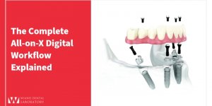 The Complete All-on-X Digital Workflow Explained