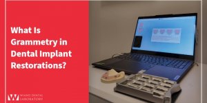 What Is Grammetry in Dental Implant Restorations?