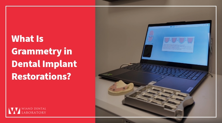 What Is Grammetry in Dental Implant Restorations?