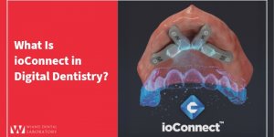 What Is ioConnect in Digital Dentistry?