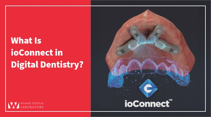What Is ioConnect in Digital Dentistry?