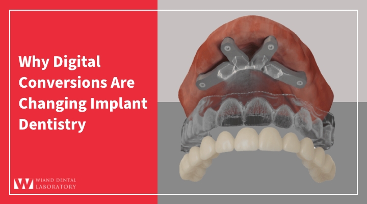 Why Digital Conversions Are Changing Implant Dentistry