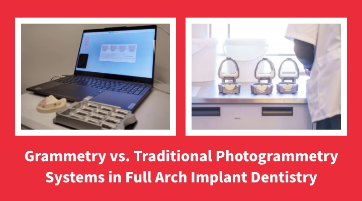 Grammetry vs. Traditional Photogrammetry Systems in Full Arch Implant Dentistry