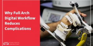 Why Full Arch Digital Workflow Reduces Complications