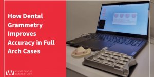 How Dental Grammetry Improves Accuracy in Full Arch Cases
