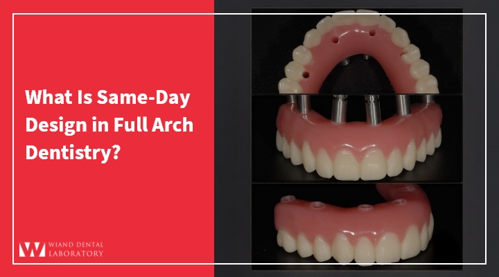 What Is Same-Day Design in Full Arch Dentistry?