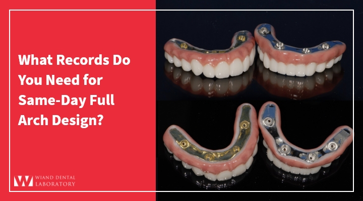 What Records Do You Need for Same-Day Full Arch Design?