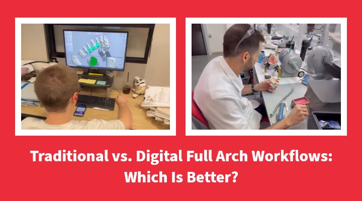 Traditional vs. Digital Full Arch Workflows: Which Is Better?