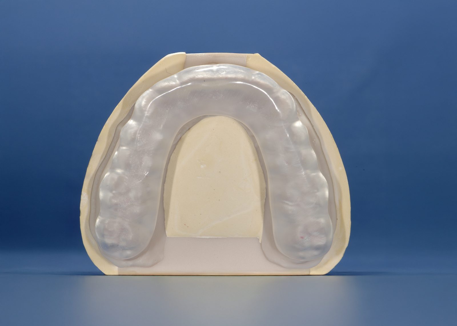 Precision Digital thermoplastic 3D-printed nightguard (placeholder photo)