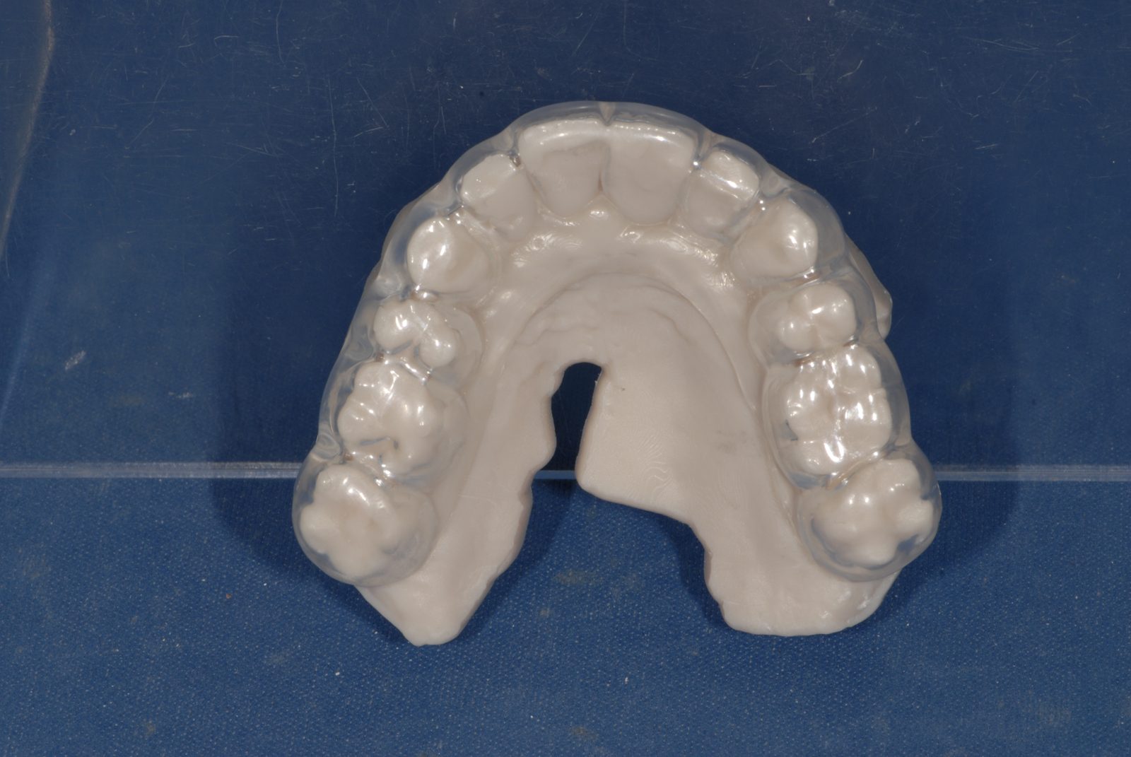 Essential Comfort hard/soft pressure-formed nightguard (placeholder photo)