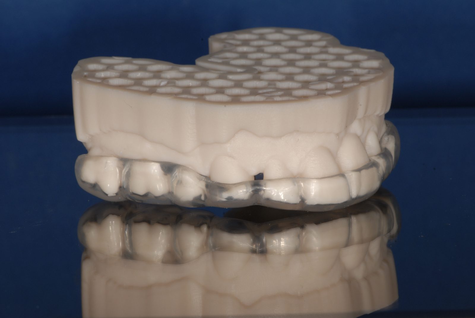 Essential Comfort hard/soft nightguard (placeholder photo)