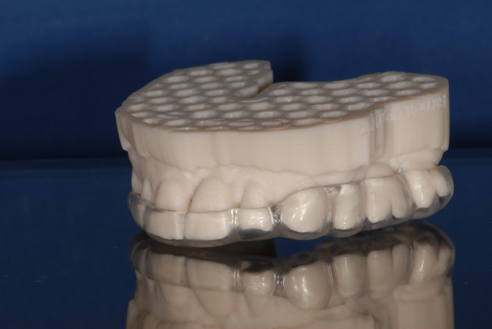 Hard/soft pressure-formed nightguard (placeholder photo)